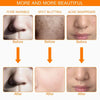 Skincare Beauty Device