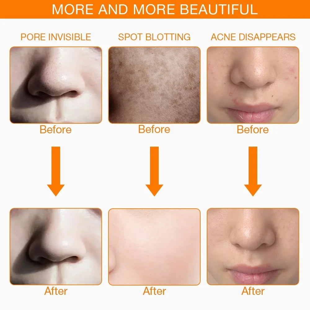 Skincare Beauty Device