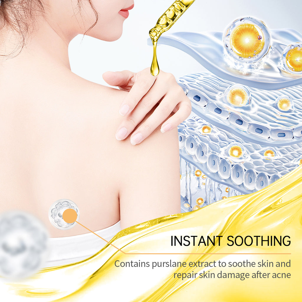 Anti-acne skincare set