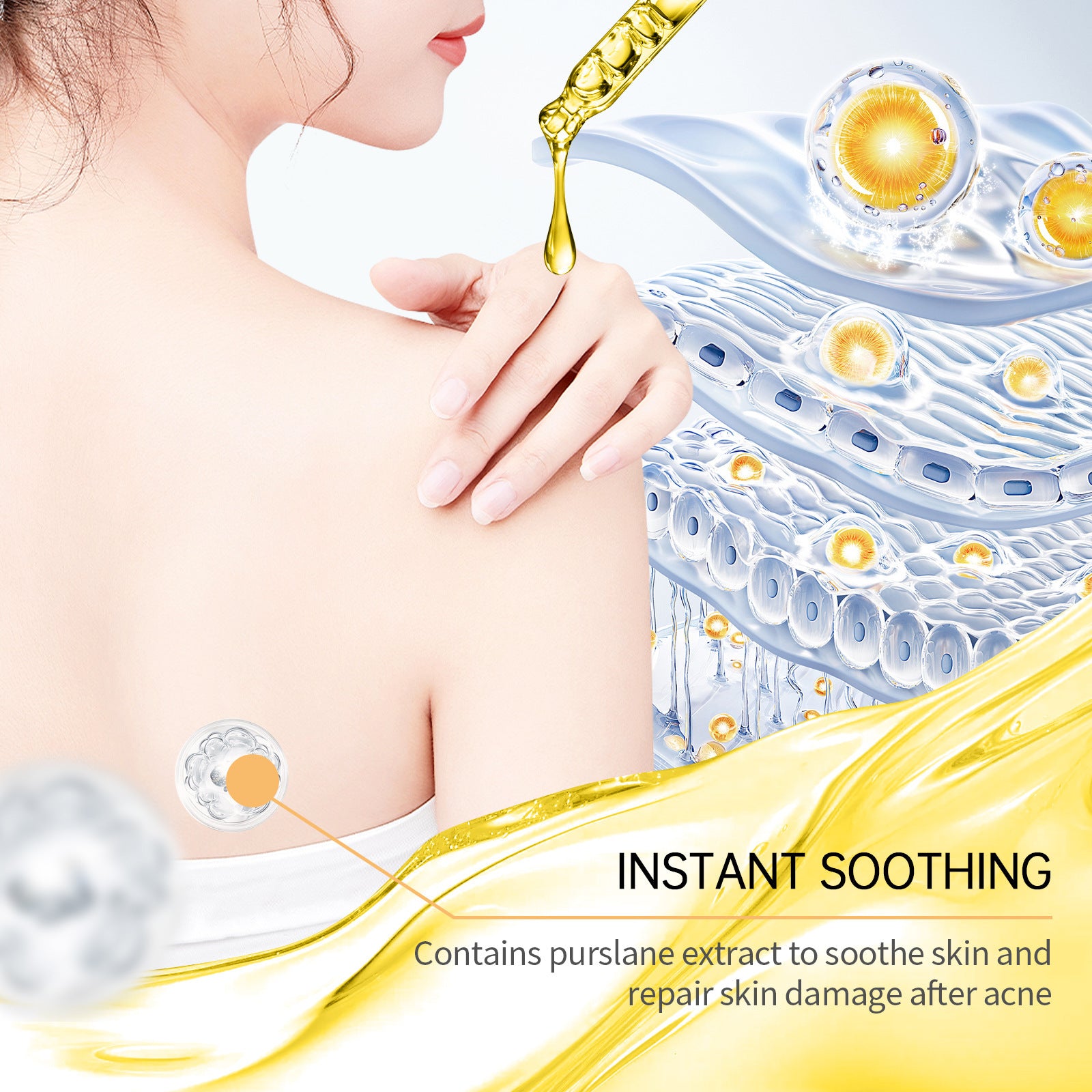 Anti-acne skincare set